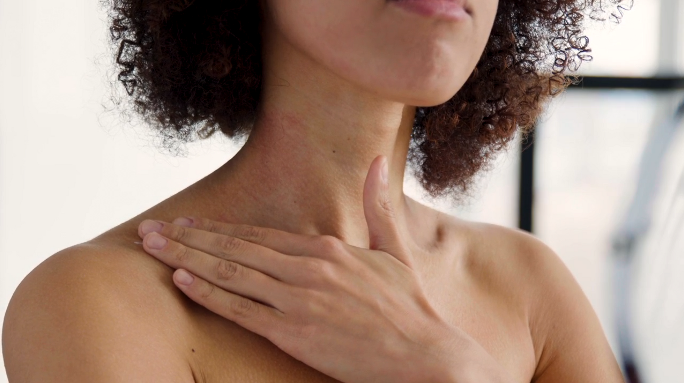 Femme touchant son cou avec une légère irritation cutanée, illustrant le besoin d’un soin hydratant et apaisant.